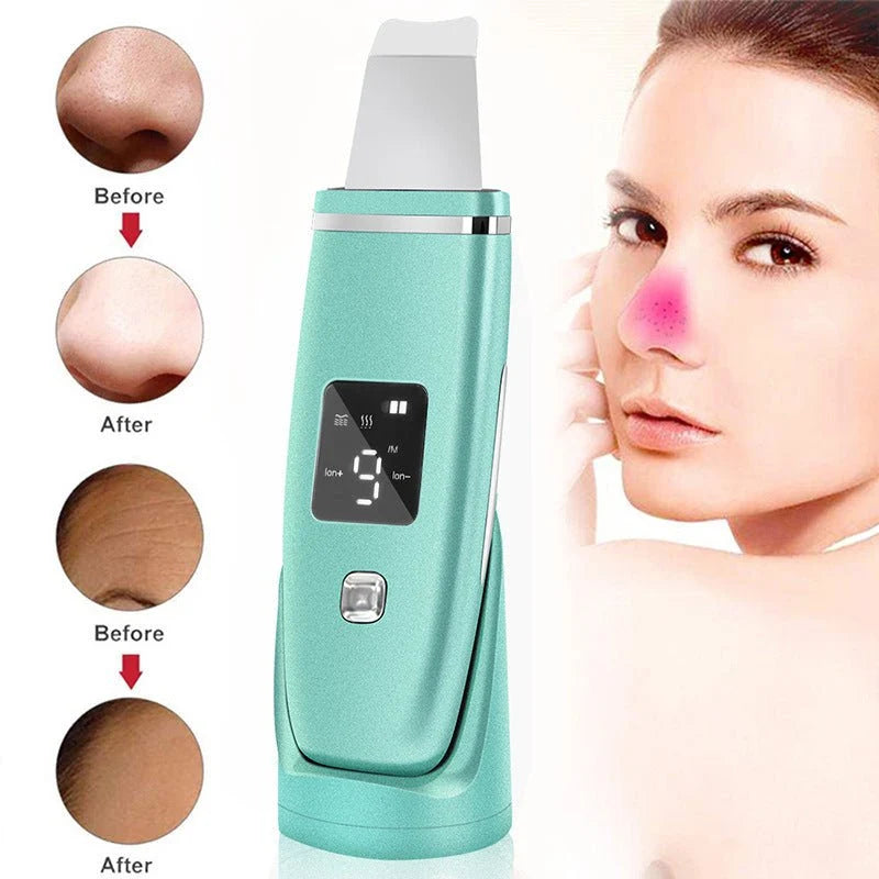 Ultrasonic Vibration Blackhead Remover Deep Cleansing Face Scrubber Pore Cleaner Lifting Machine